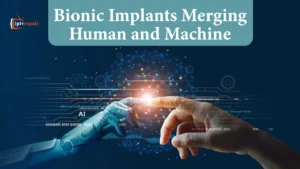 Bionic Implants Merging Human and Machine